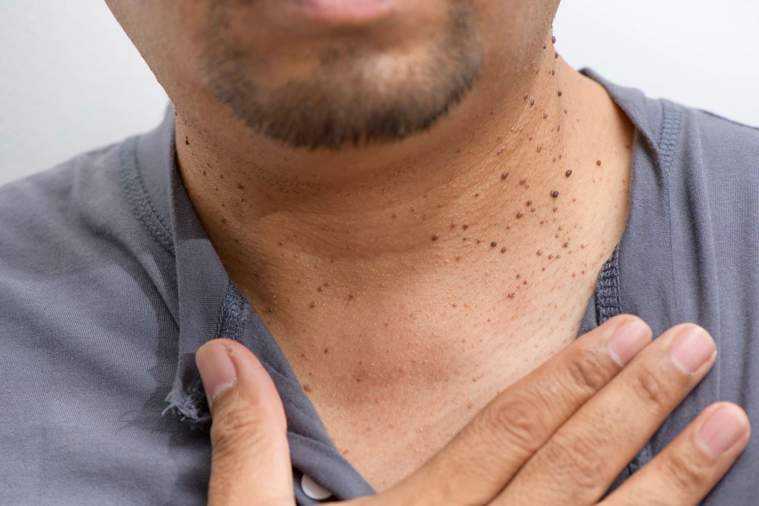 Health-shutterstock_1796309251-ec4d1fcd671b47ed885adbaad5167634