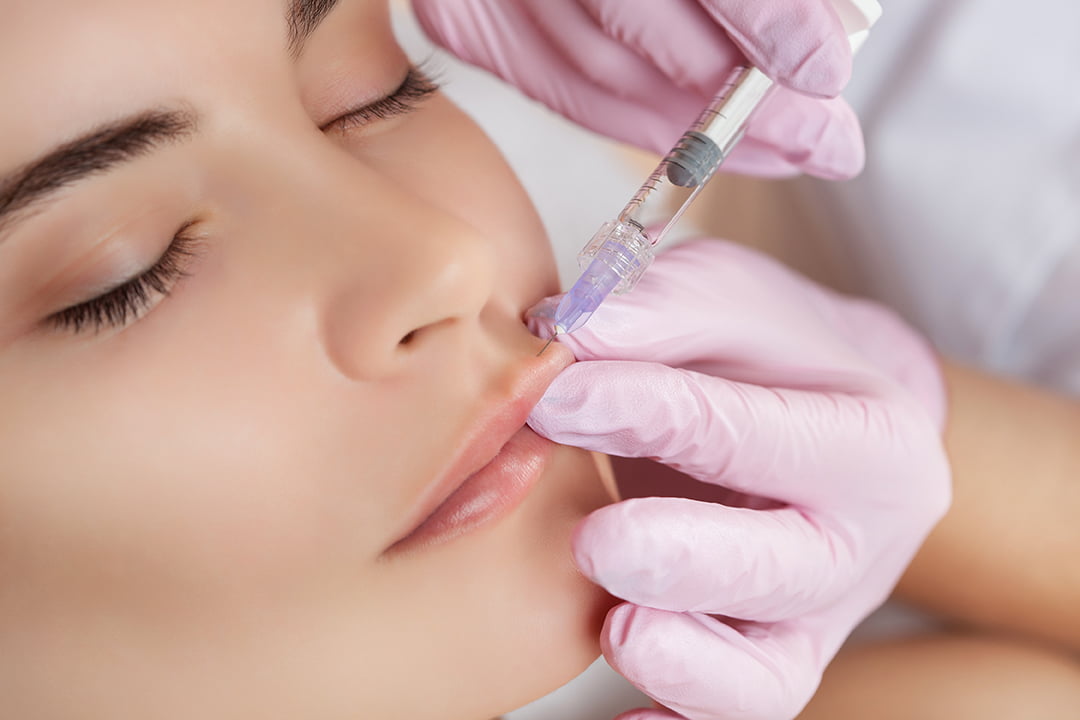 Here-are-5-things-you-need-to-know-about-BOTOX-lip-flip