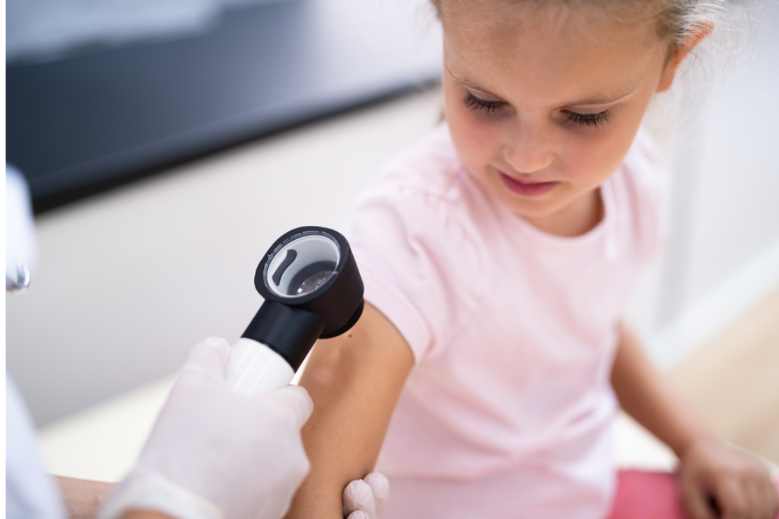 Pediatric-Dermatology-Services