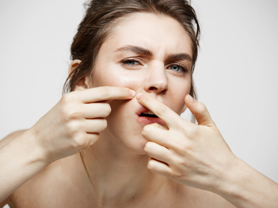 “Dermatologist explaining why popping pimples causes scars – acne scar treatment in Mira Road and Mumbai”