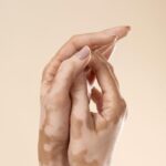 Vitiligo myths explained by vitiligo specialist in Mira Road Mumbai