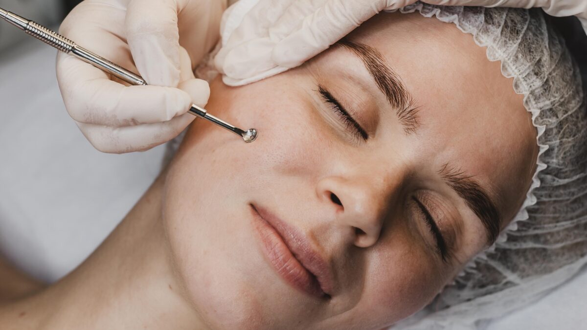 Best dermatologist providing acne treatment in Mira Road Mumbai for stubborn acne.