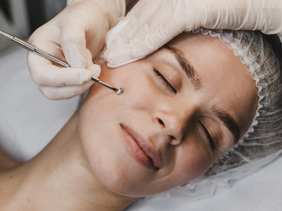 Best dermatologist providing acne treatment in Mira Road Mumbai for stubborn acne.