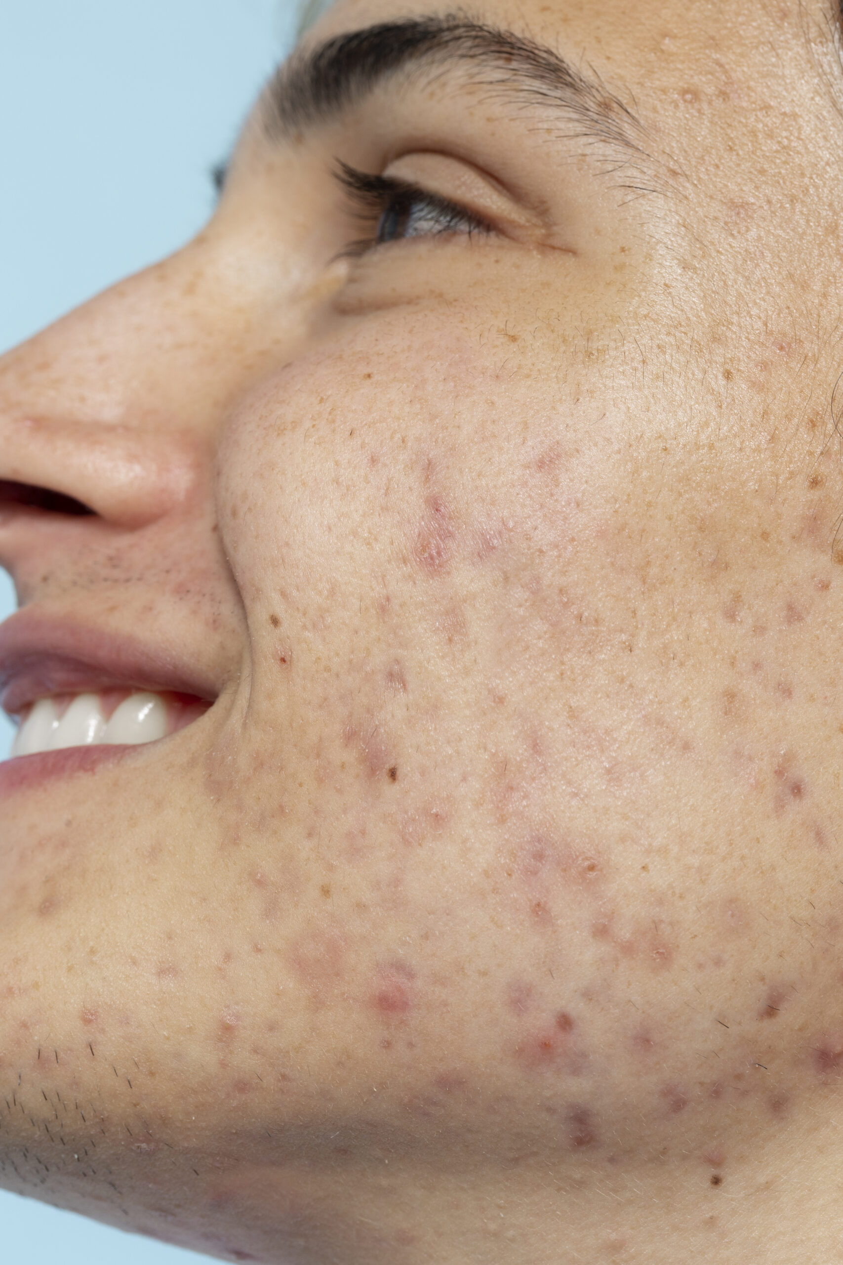 Dermatologist evaluating facial pigmentation