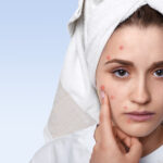 Dermatologist examining acne scars during acne scar treatment in Mira Road Mumbai